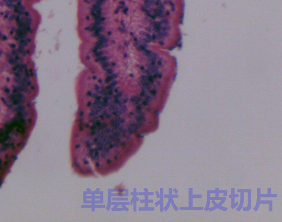 單層柱狀上皮切片